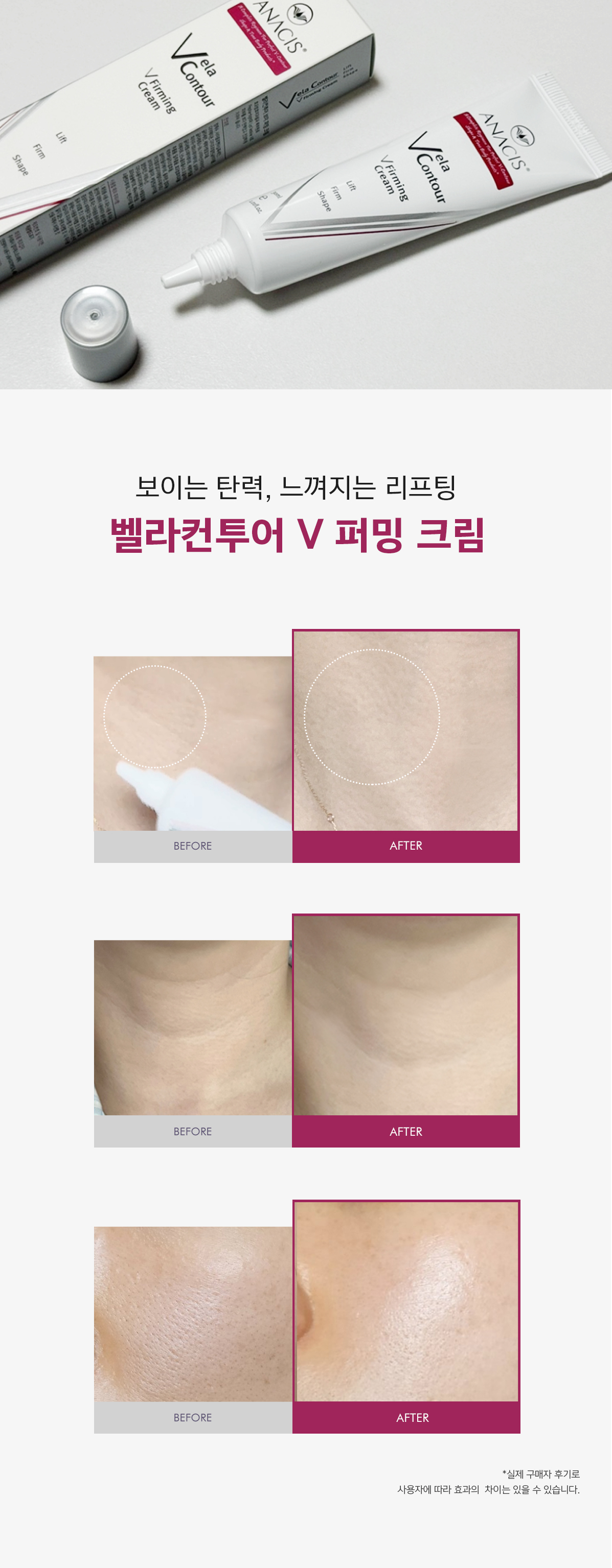 벨라컨투어 아이백 눈밑지방 탄력 크림 30ml 상세 이미지 3