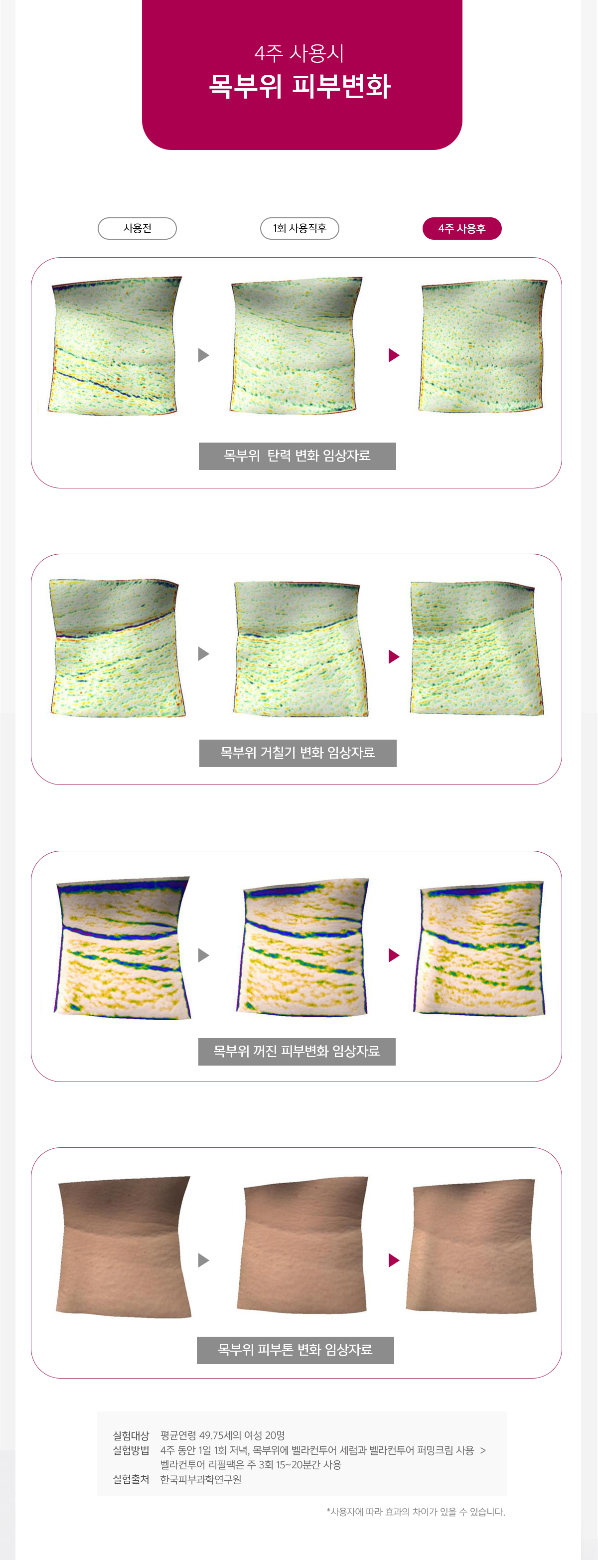 벨라컨투어 아이백 눈밑지방 탄력 크림 30ml 상세 이미지 5