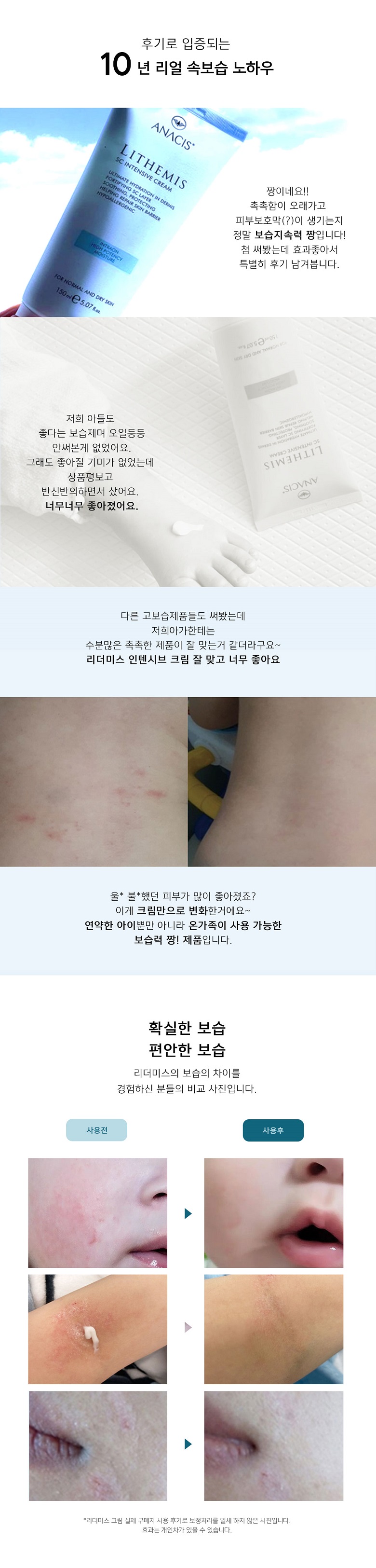 리더미스 속건조 판테놀 앰플 크림 기초 화장품 세트 상세 이미지 5