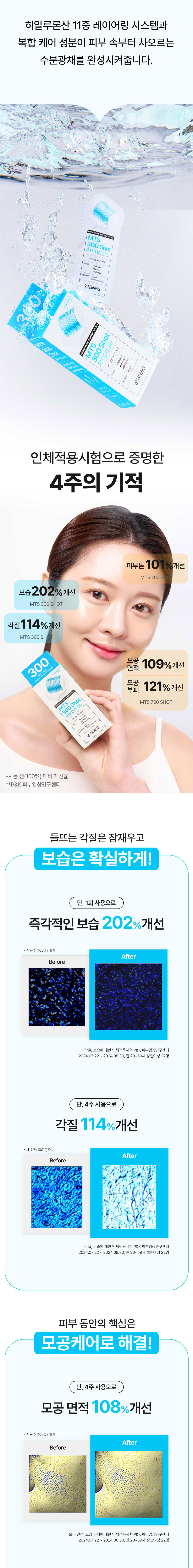 비앤비지 엠티에스 각질케어 보습 수분보충 앰플 300히알샷 상세 이미지 5