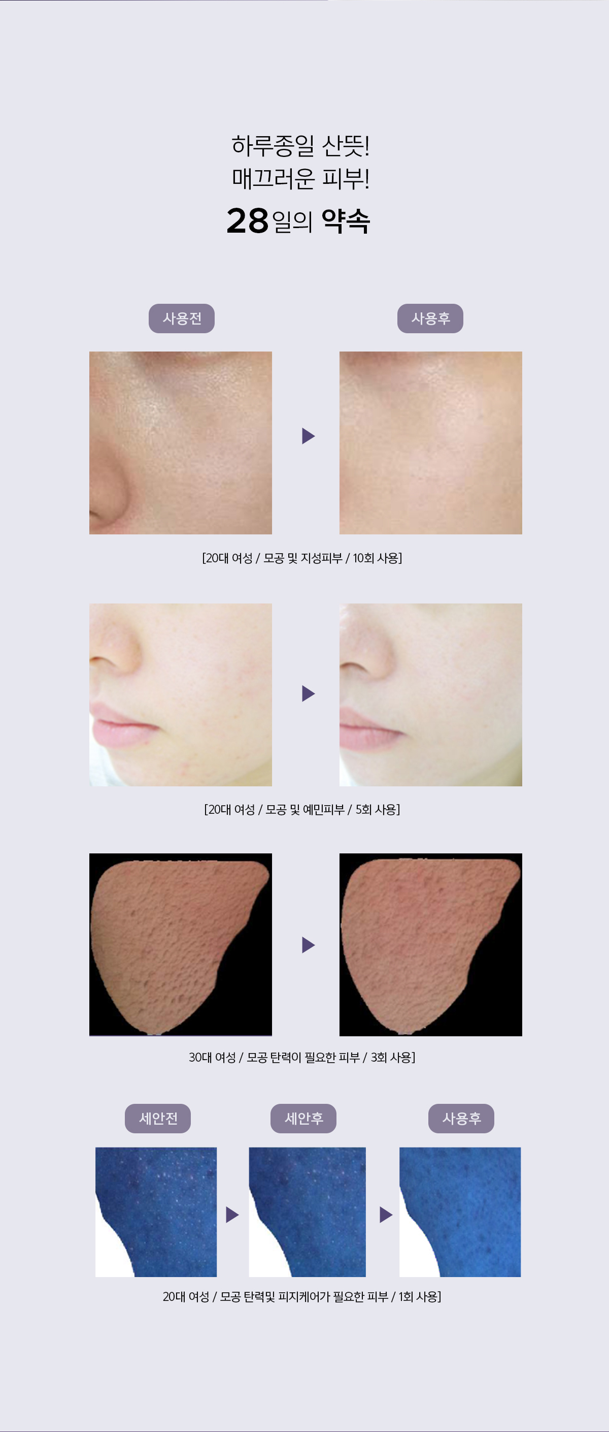 아클레온 여드름 수부지 히알루론산 센텔라 모공 피지연화 앰플55ml 상세 이미지 2
